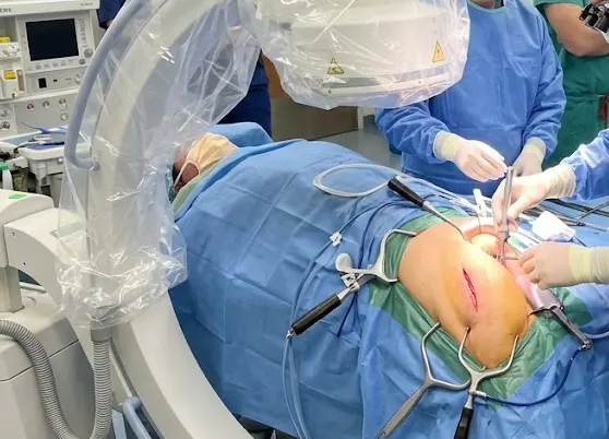Hip Replacement